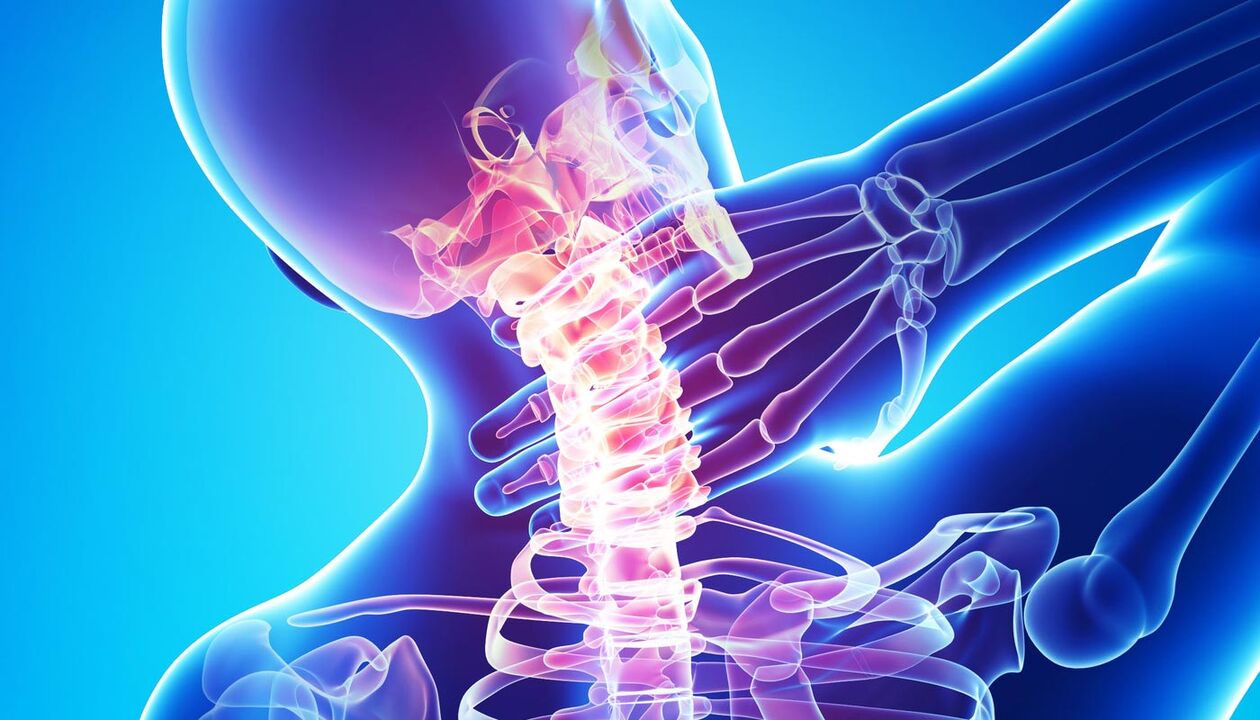 bolečine v vratu zaradi osteohondroze